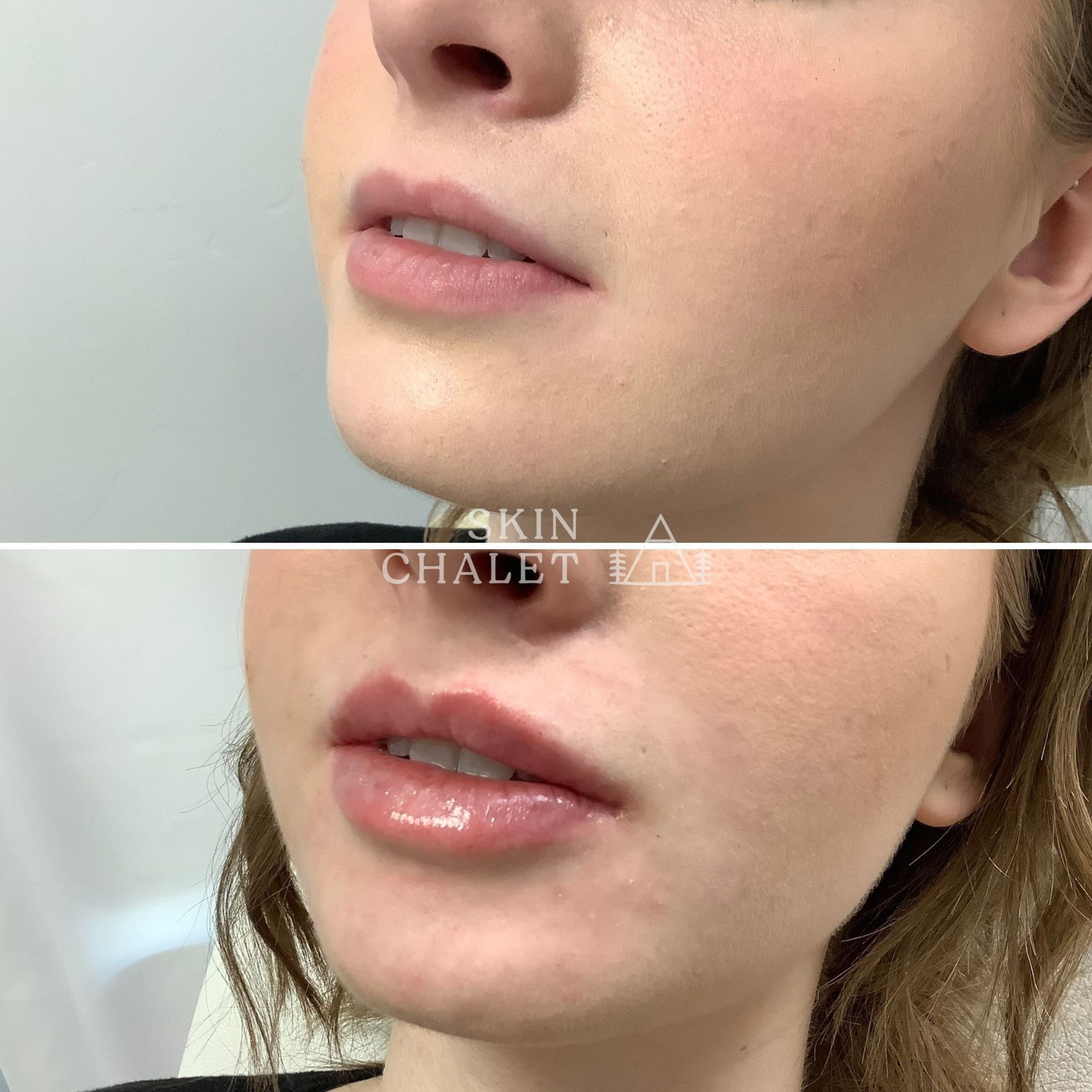 Lips 55