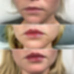 Lips 8.jpg