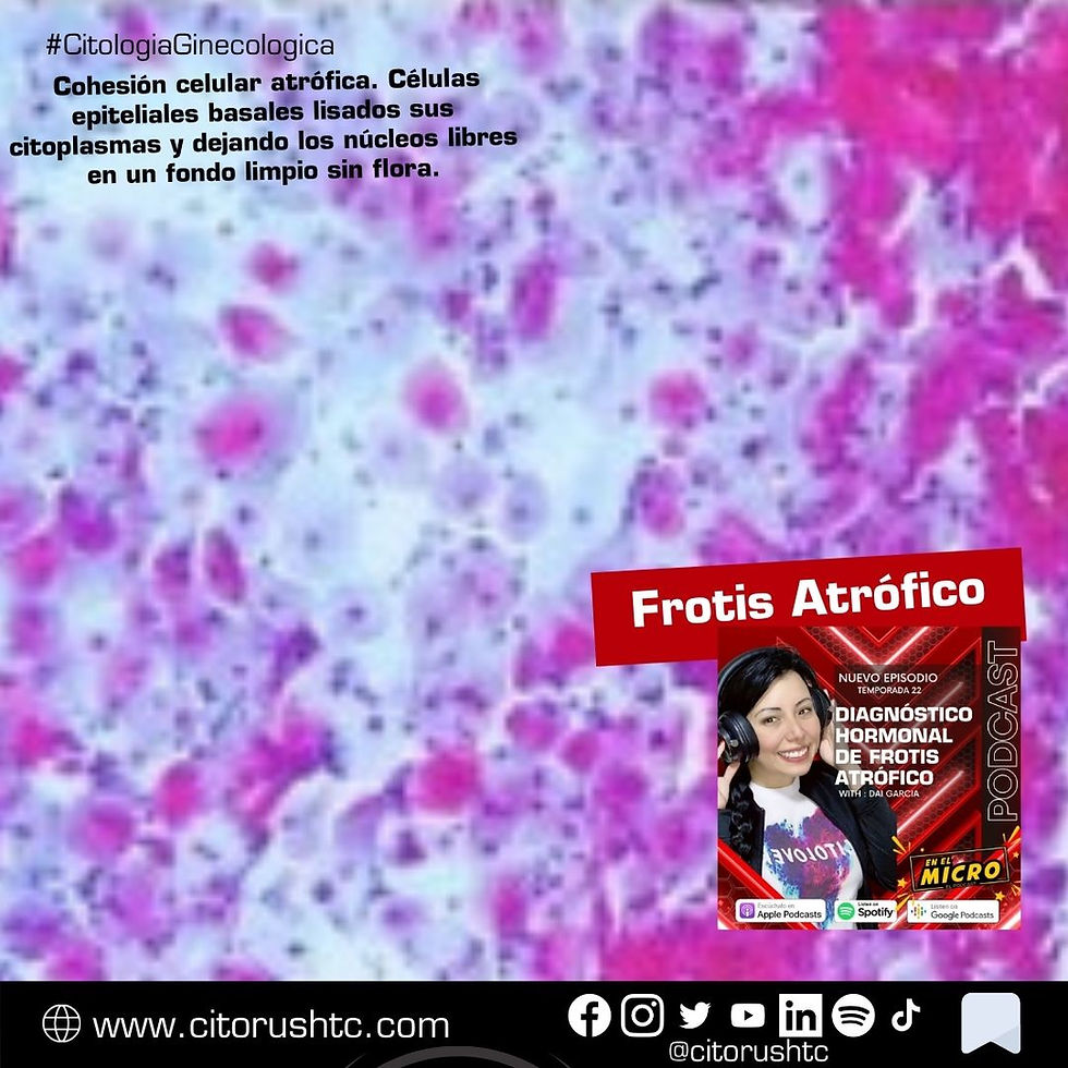 Células epiteliales basales lisados sus citoplasmas y dejando los núcleos libres en un fondo limpio sin flora.