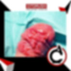 ree