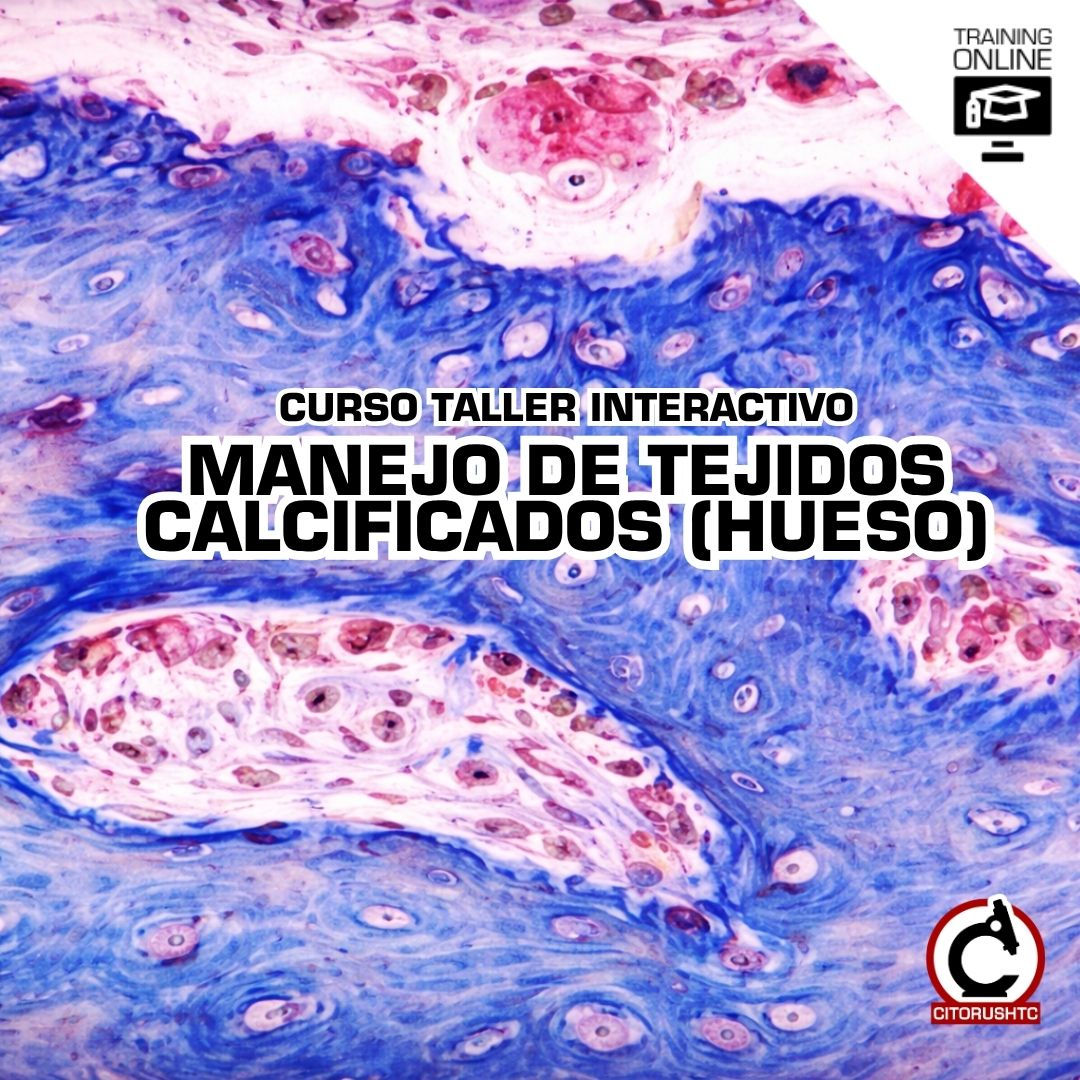 CTC-CTIC45- Manejo de Tejidos Calcificados (Hueso)
