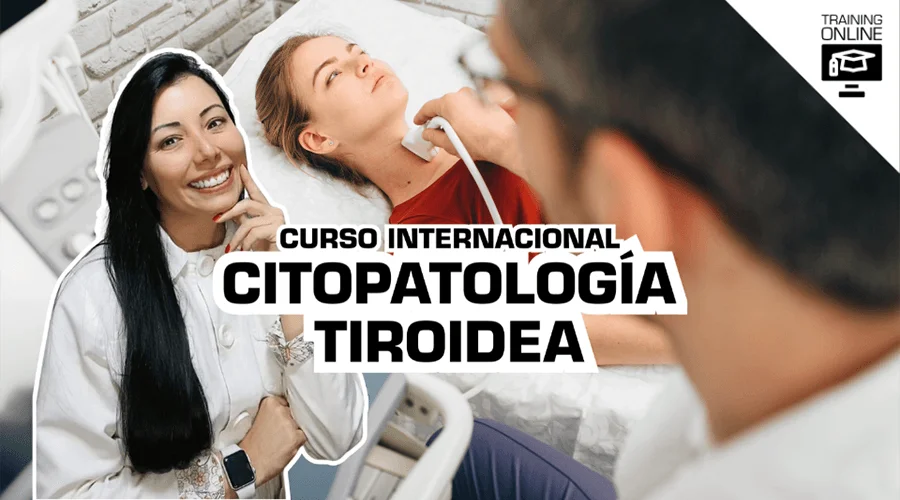 CURSO CITOPATOLOGIA TIROIDEA - CITORUSHTC.webp