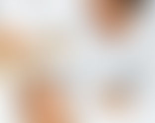Dermal Fillers: When and Why You Need Them