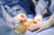 hand surgeon derry