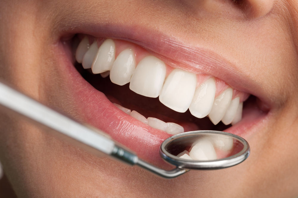 Over the counter teeth whitening vs. dentist