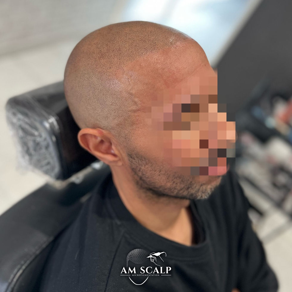 dermopigmentation