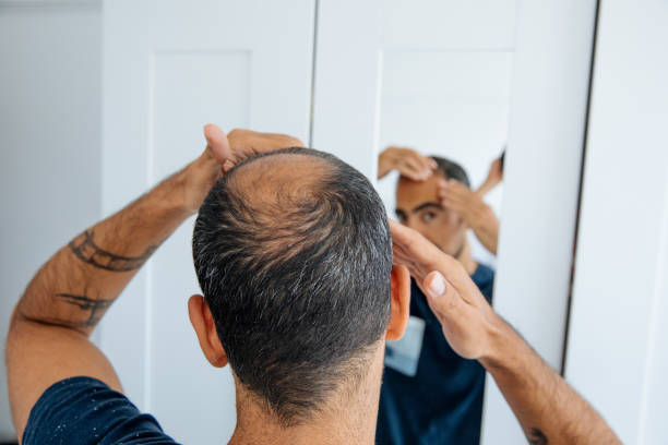 tricopigmentation