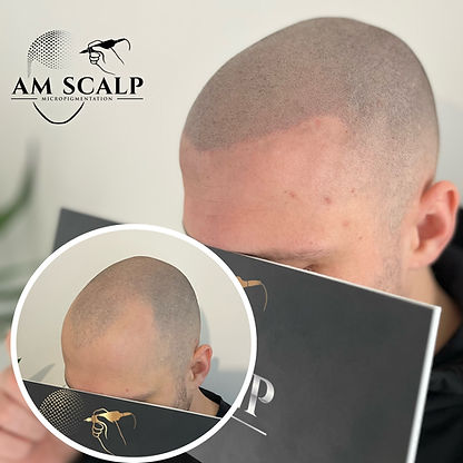 Tricopigmentation prix