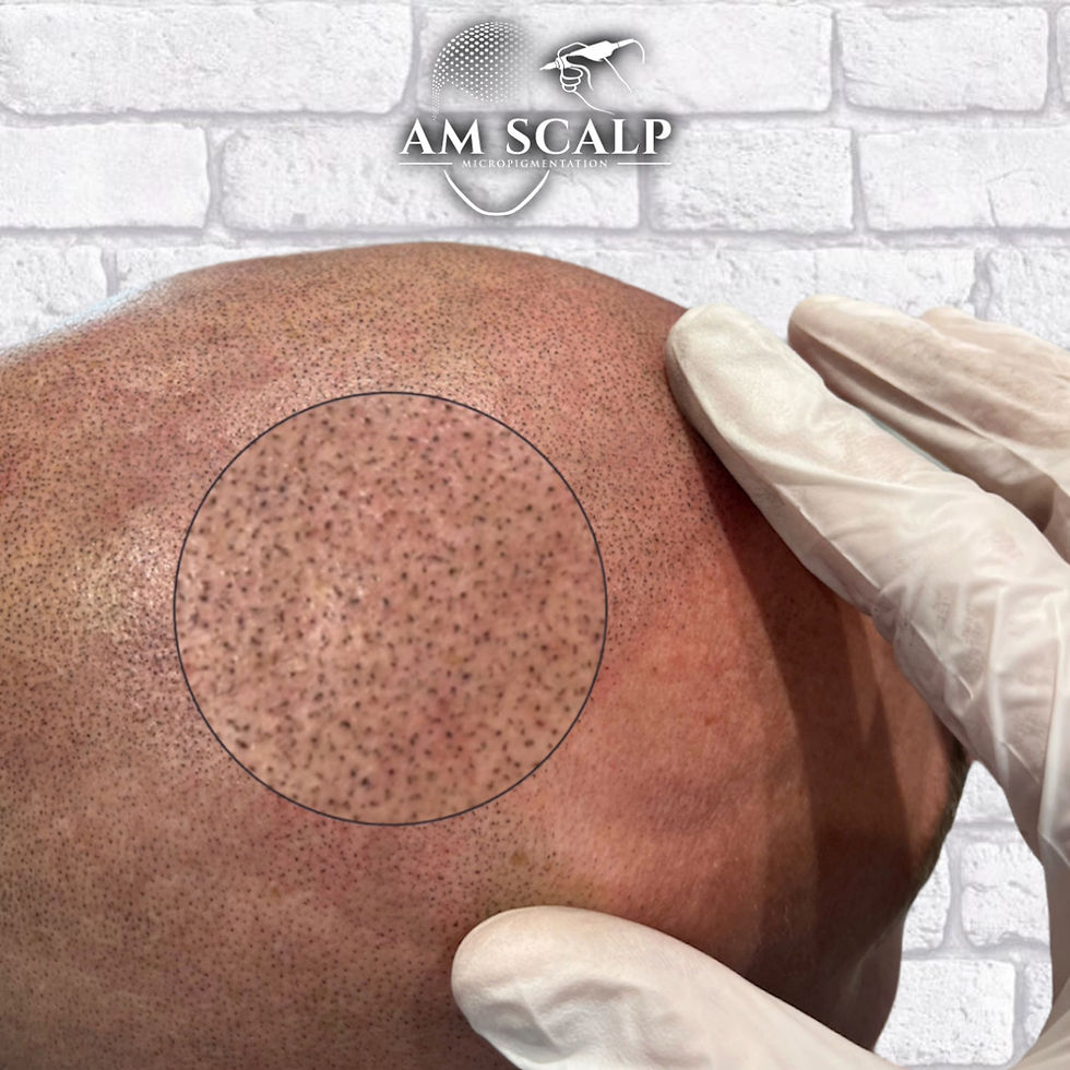 tricopigmentation