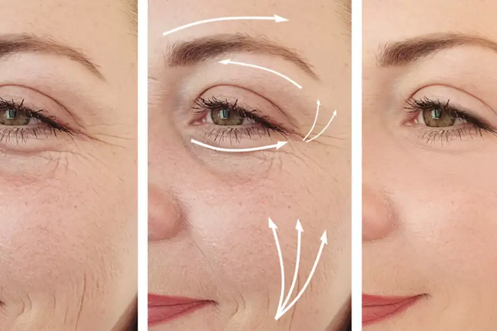 eMatrix® Face, Neck & Décolleté Rejuvenation in Alpharetta, GA | Lazuk Esthetics