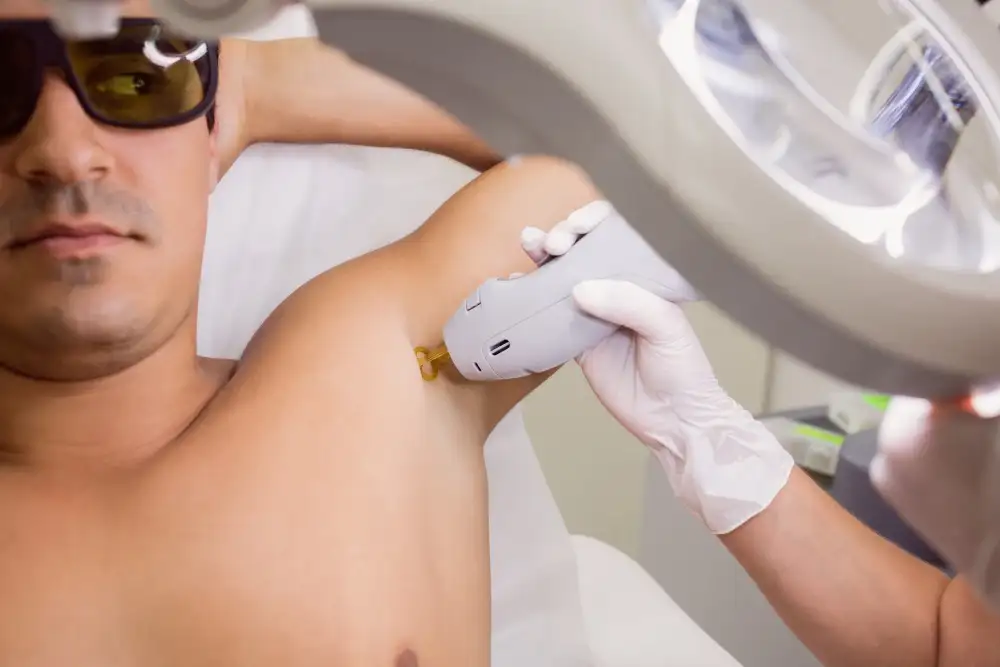 Candela Laser Hair Removal "For Men" in Alpharetta GA | Lazuk Esthetics