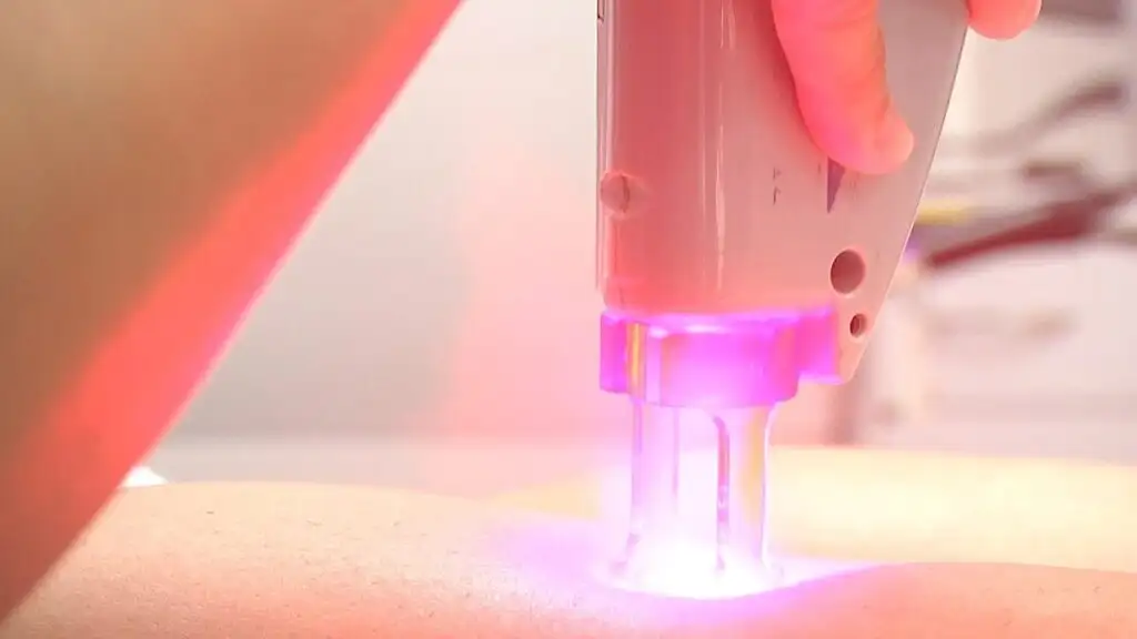 Total Skin Rejuvenation with Candela® Laser Facial | Alpharetta, GA