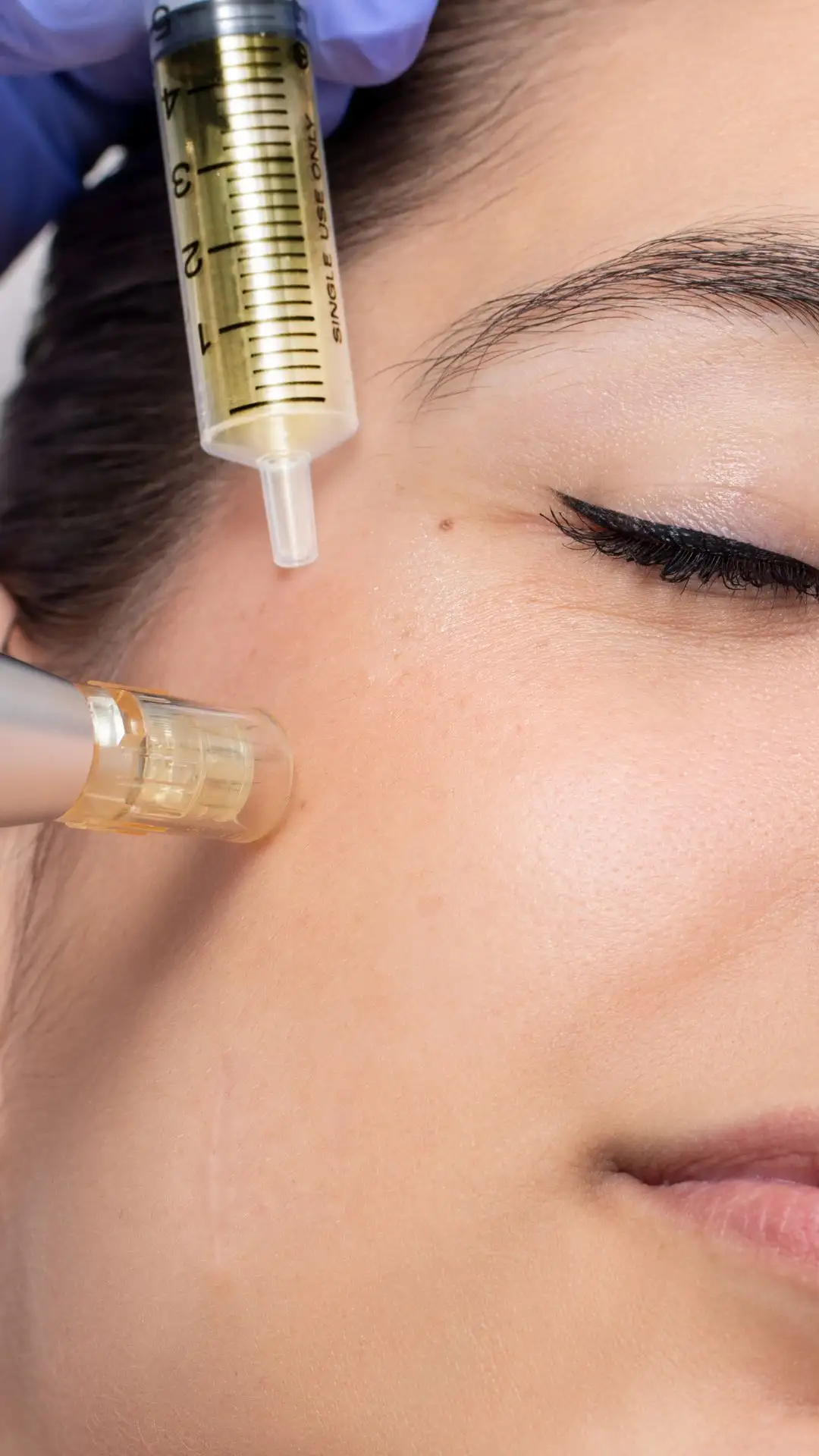 PRP (Platelet-Rich Plasma) Treatments, Lazuk Esthetics, Alpharetta, GA