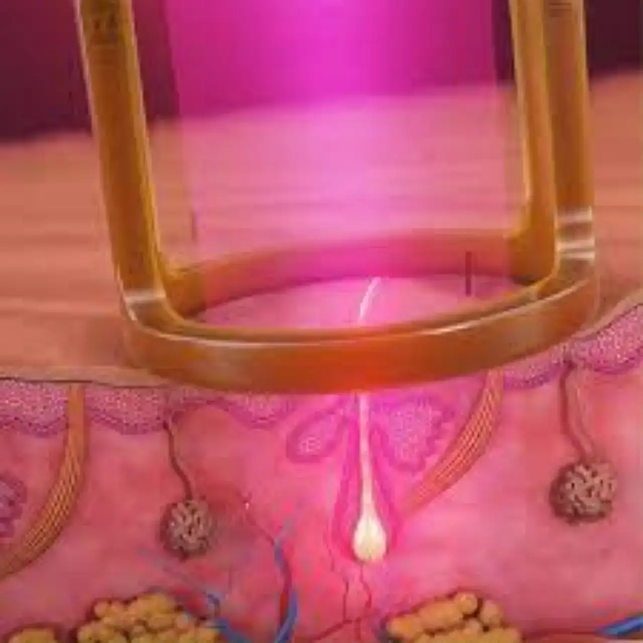 Total Skin Rejuvenation with Candela® Laser Facial | Alpharetta, GA