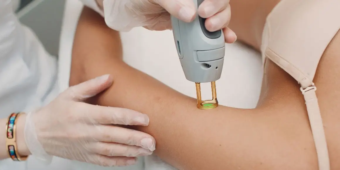 Laser hair removal for your arms in Alpharetta, GA, Lazuk Esthetics