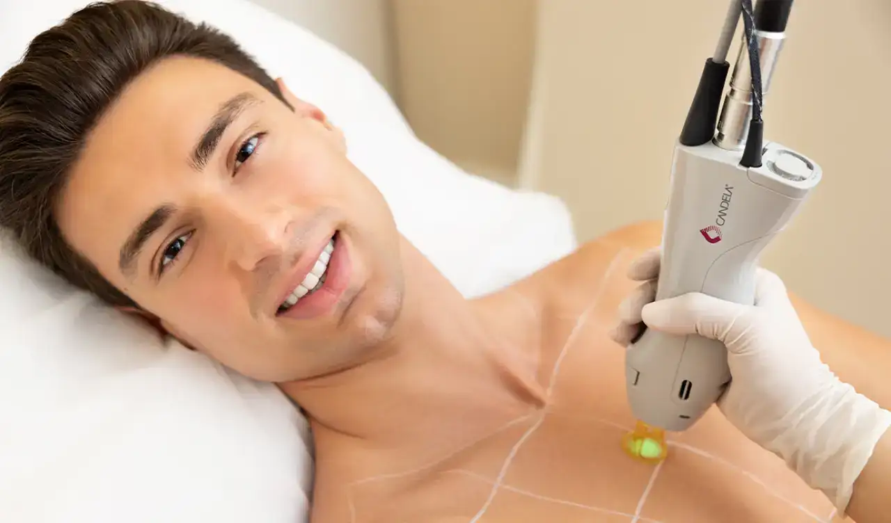 Candela Laser Hair Removal "For Men" in Alpharetta GA | Lazuk Esthetics