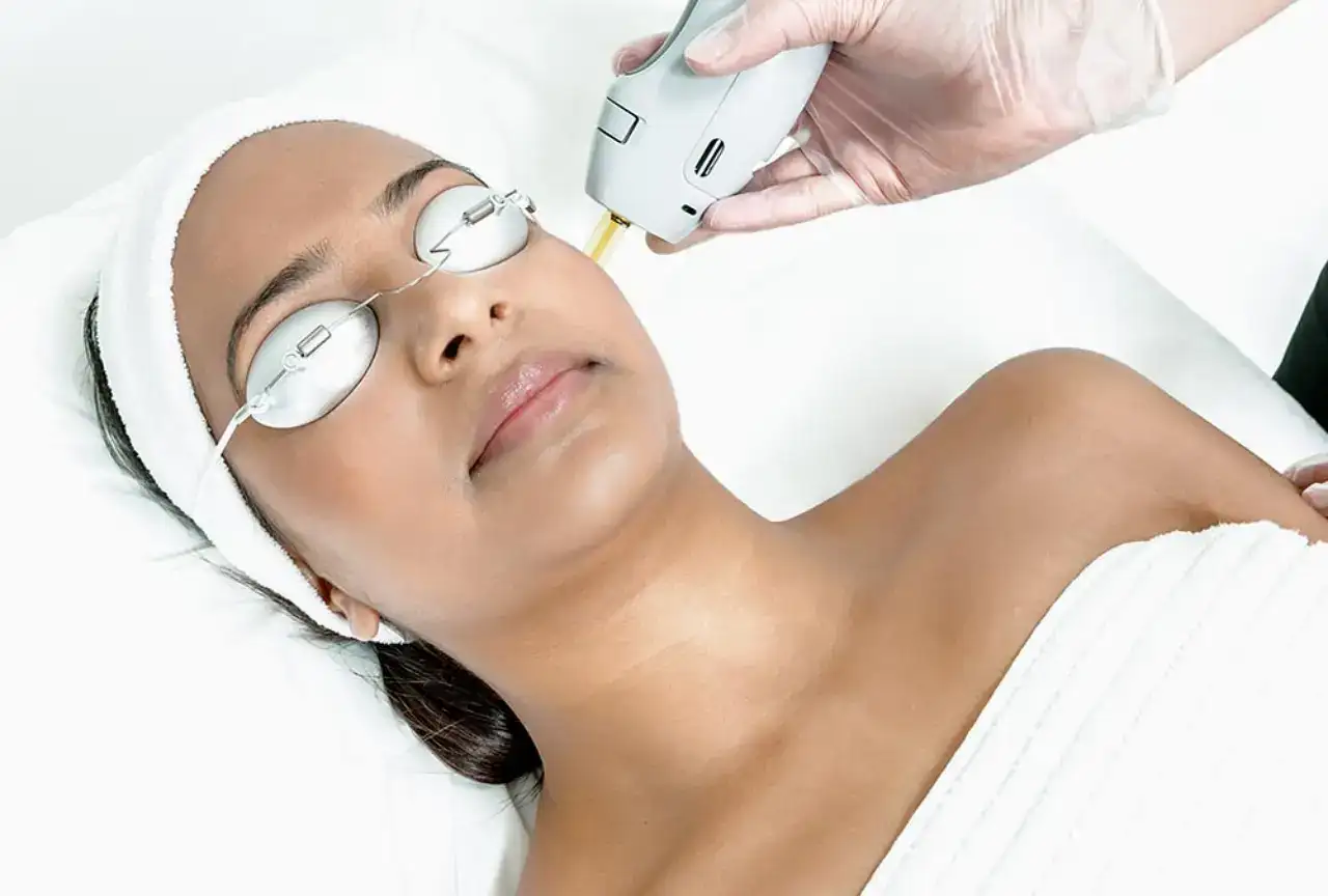 Total Skin Rejuvenation with Candela® Laser Facial | Alpharetta, GA