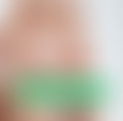 skincare routine not working, skin barrier repair, dehydrated vs dry skin, inflammation and skin, over exfoliation damage, sensitive skin causes, skincare mistakes, skin health strategy, barrier dysfunction, reactive skin, acne triggers, skin hydration, minimalist skincare, AI skin analysis, skincare troubleshooting, skin consistency, dermatology insights, skin longevity, product overload, skin repair strategies | Lazuk Esthetics, Alpharetta, GA