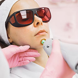 Candela® Laser Hair Removal for Small Areas in Alpharetta, GA | Lazuk Esthetics