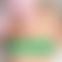 polynucleotides skincare, PDRN explained, salmon DNA skin treatment, PDRN injection benefits, topical PDRN serum, polynucleotide vs filler, polynucleotide vs hyaluronic acid, PDRN under eye, PDRN for acne scars, regenerative skincare ingredients, bioidentical skincare trend