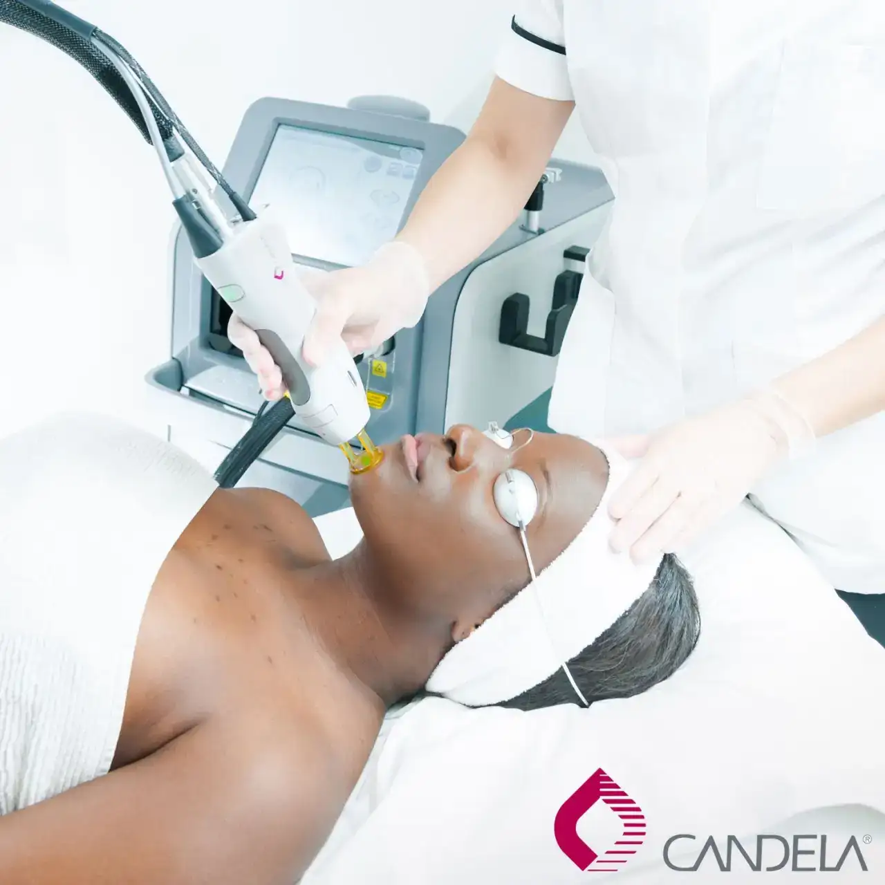 Total Skin Rejuvenation with Candela® Laser Facial | Alpharetta, GA