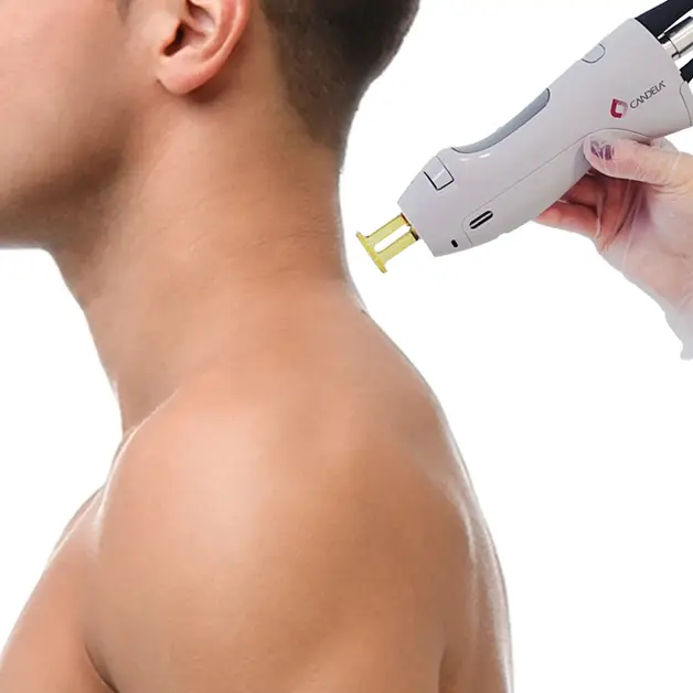 Laser hair removal treatment on your neck using Candela technology at Lazuk Esthetics, Alpharetta, GA