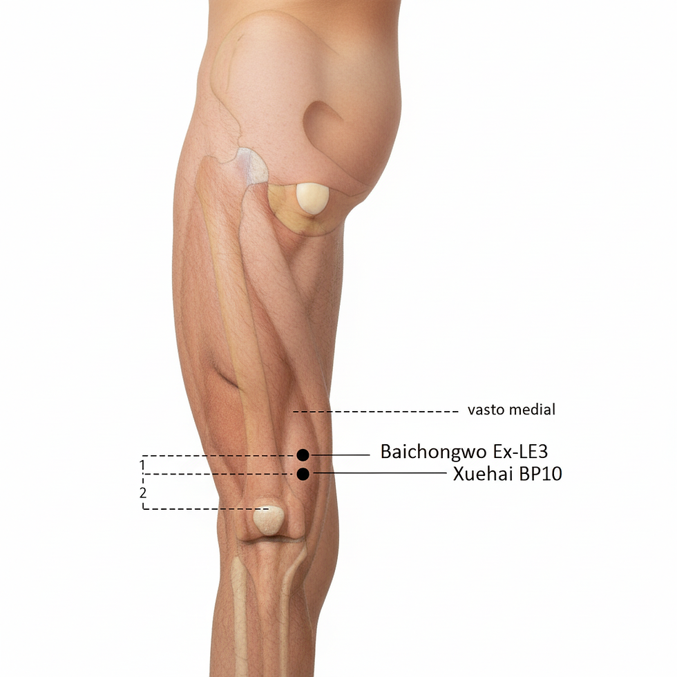 Ponto extra de acupuntura Ex-LE3 Baichongwo localizado cerca de 1 cun acima de SP10 (Xuehai) na coxa, utilizado em distúrbios de pele, eczema, parasitas e alergias
