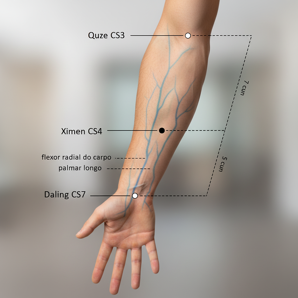 Ilustração anatômica do ponto de acupuntura CS4 Ximen (Porta da Fenda), no antebraço, e sua função crucial no tratamento de dor cardíaca aguda (angina), palpitações e por acalmar o espírito em casos de agitação