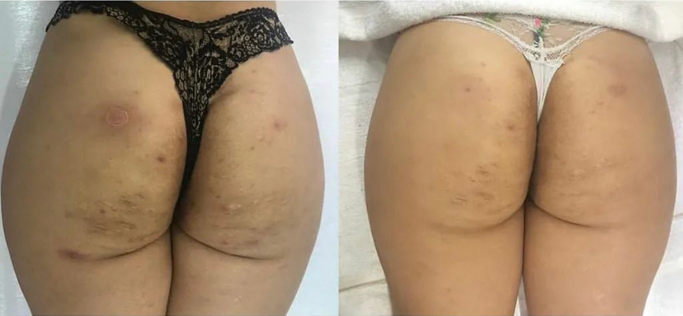 Doll Ernest Beauty: Peeling Körper & Gesicht 8