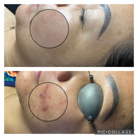 Skin by abie transformation e.jpg