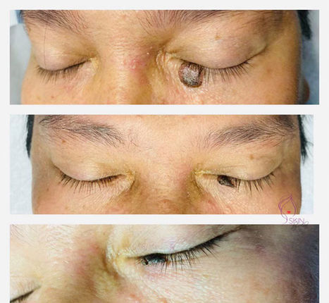 Skin by abie transformation 2.jpg
