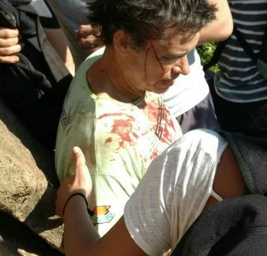 Homem sofre acidente na Pedra da Gávea, Rio