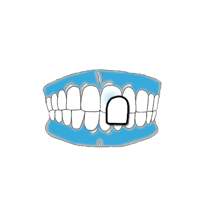 FACCETTE ESTETICHE