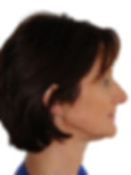 Profil avancée mandibulaire.jpg