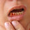 Thumbnail: Stop Teeth Bleeding & Bad Smell, Anti Gingivitis Herbs Toothpaste