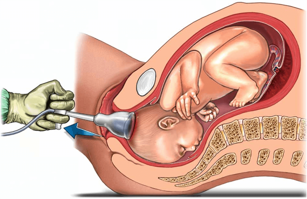 Normal and Assisted Vaginal Delivery