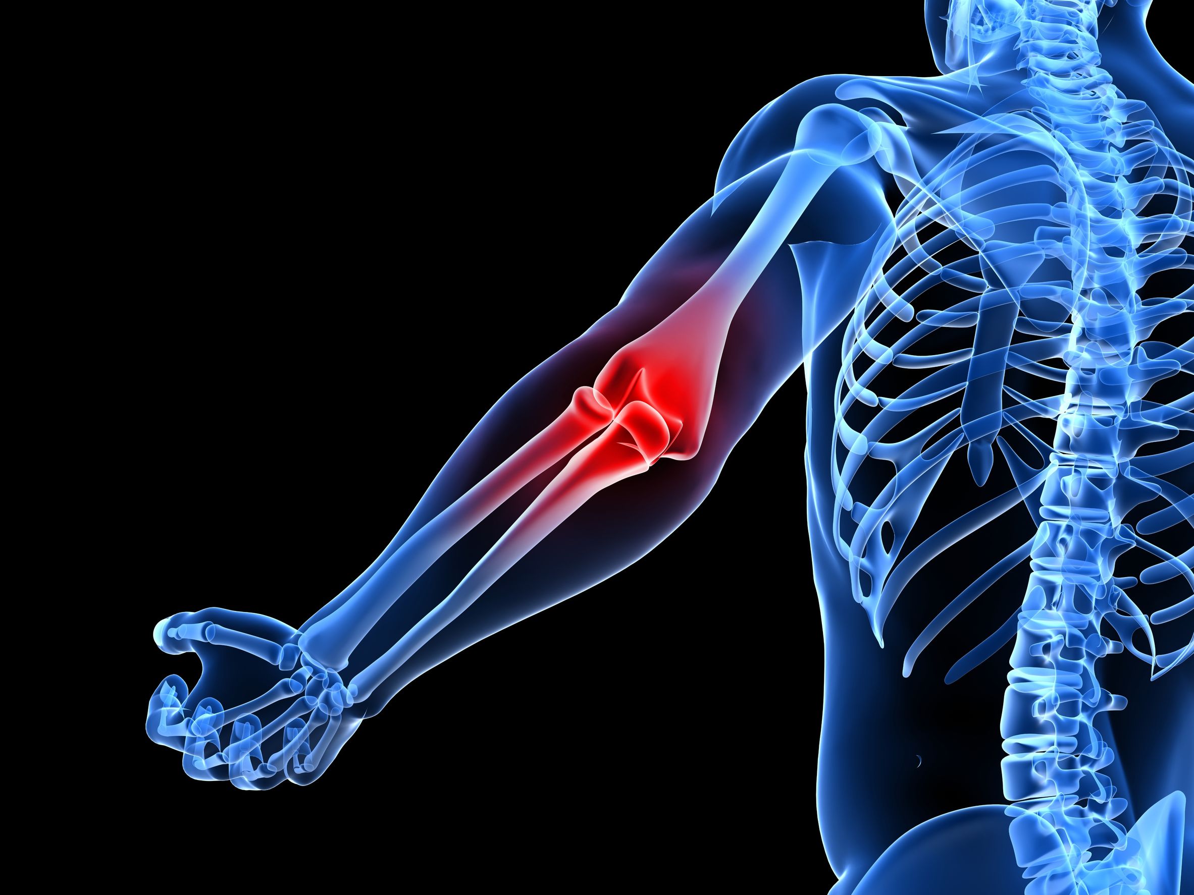Elbow Pain