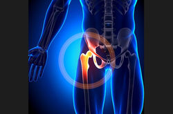 Hip Pain