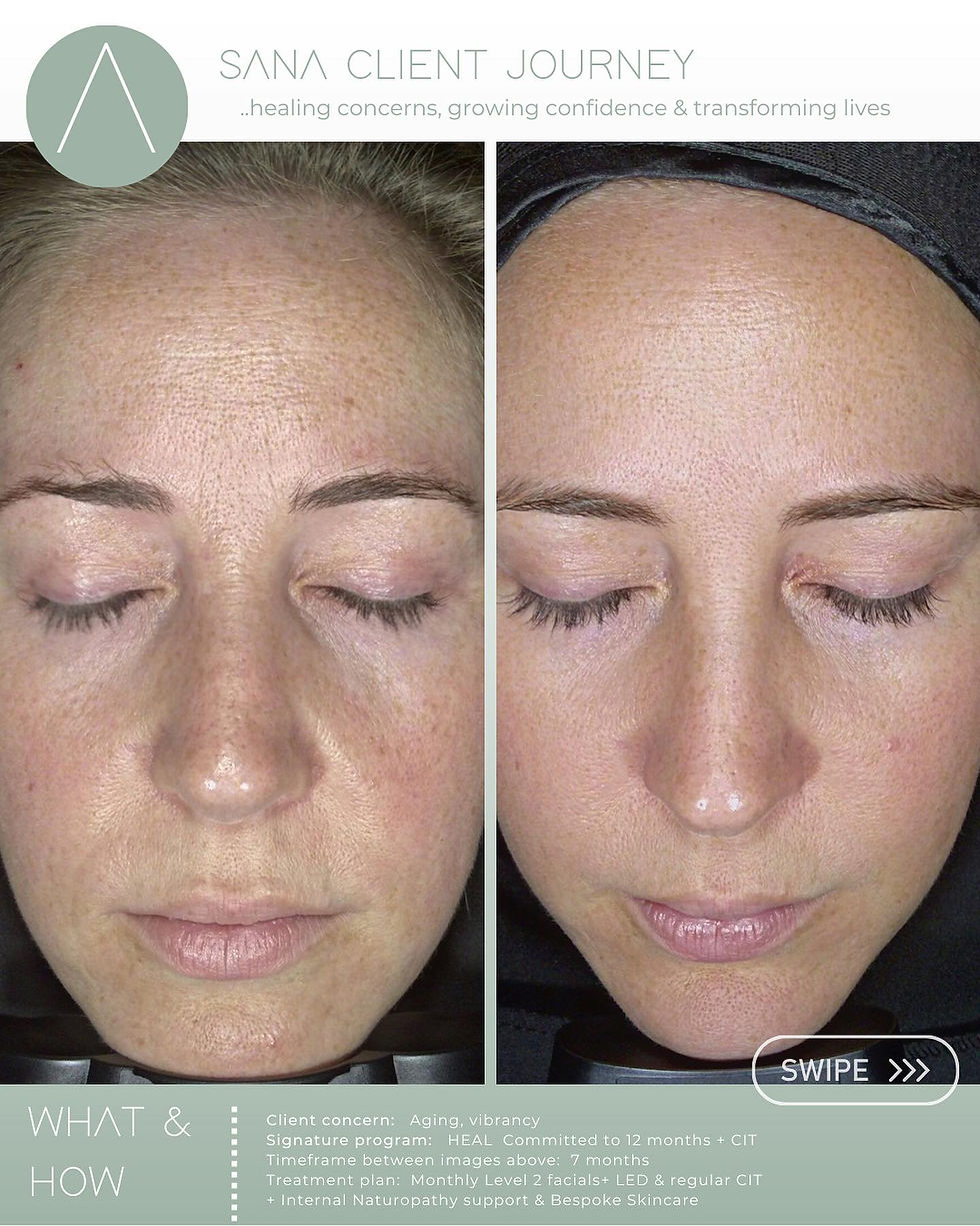 Award winning transformation