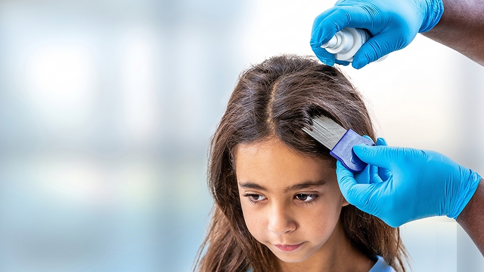 A person wearing blue latex gloves applying a spray treatment while combing through a young girl's dark hair with a nit comb.