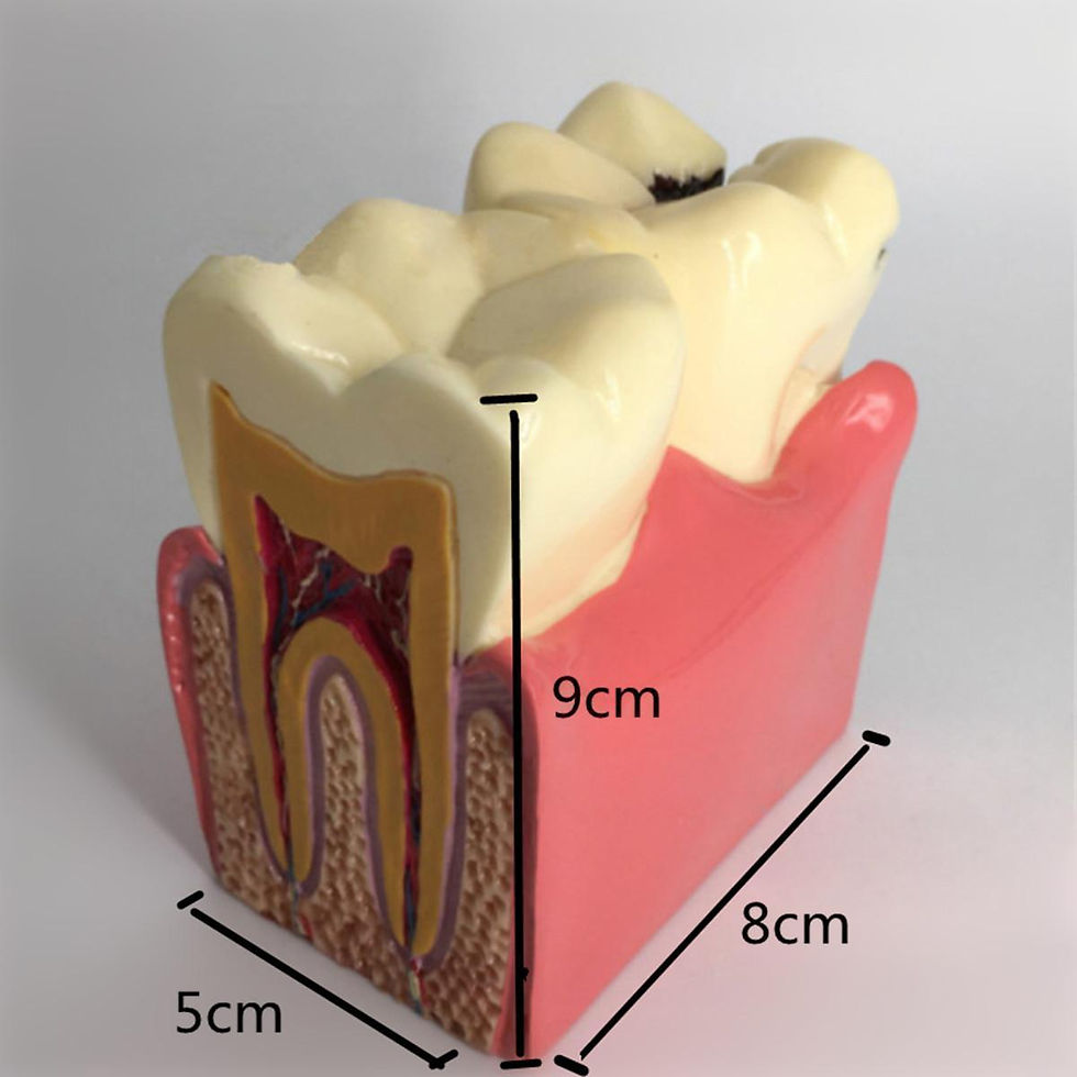 섬네일: 6 Times Caries Comparation Study Model