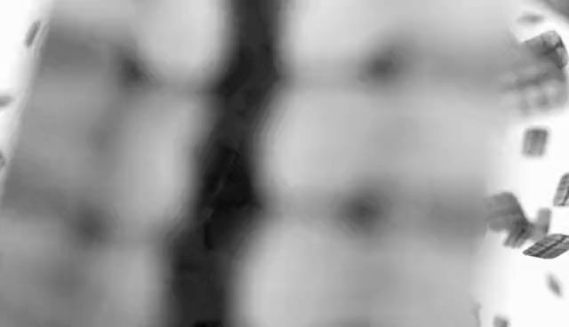 Thumbnail: Nanopix Intraoral X-Ray Sensor (China)