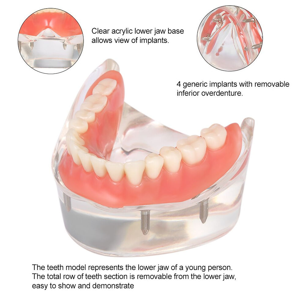 Thumbnail: Dental Overdenture Dental Teeth Model Interior Mandibular Lower Teeth Model Mand