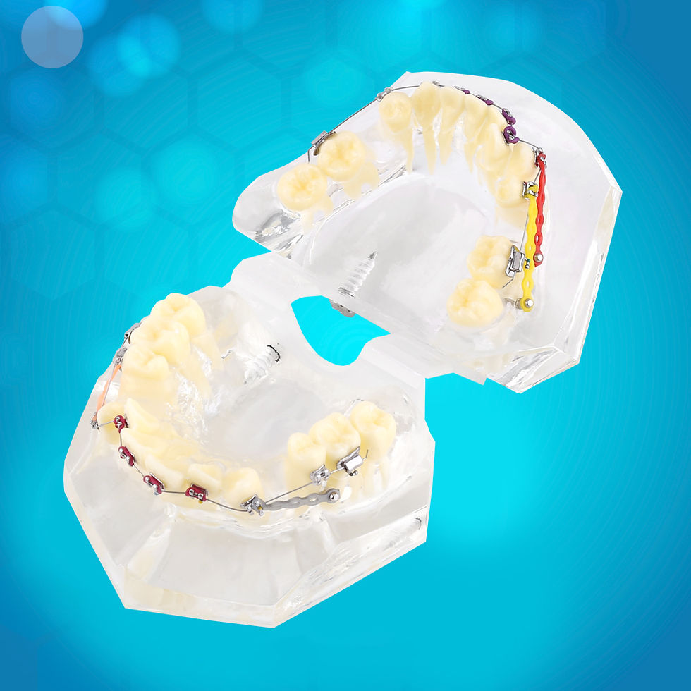 Миниатюра: Dental Orthodontic Treatment Malocclusion Study Teeth Model With Wire Chain