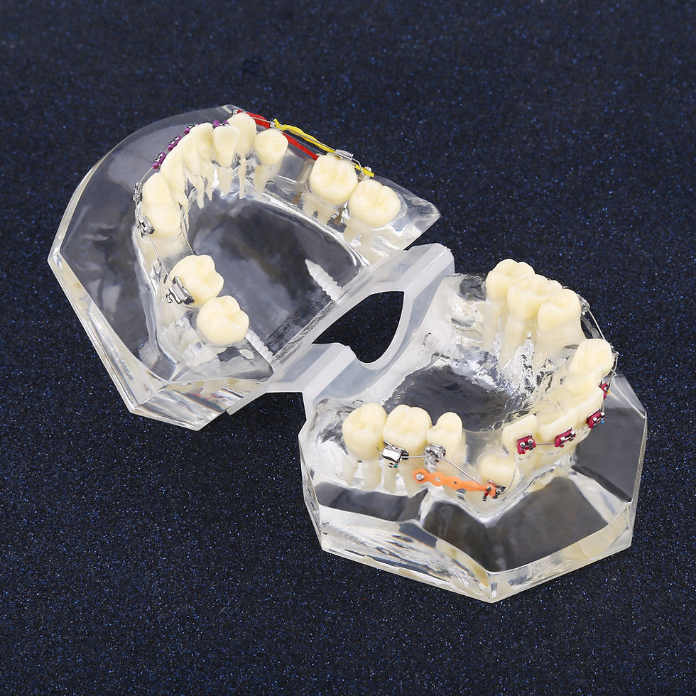 縮圖：Dental Orthodontic Treatment Malocclusion Study Teeth Model With Wire Chain