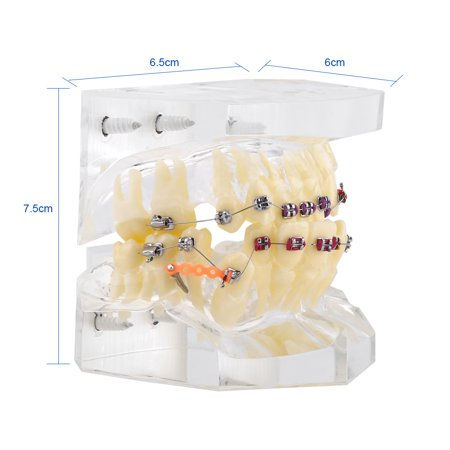 Миниатюра: Dental Orthodontic Treatment Malocclusion Study Teeth Model With Wire Chain