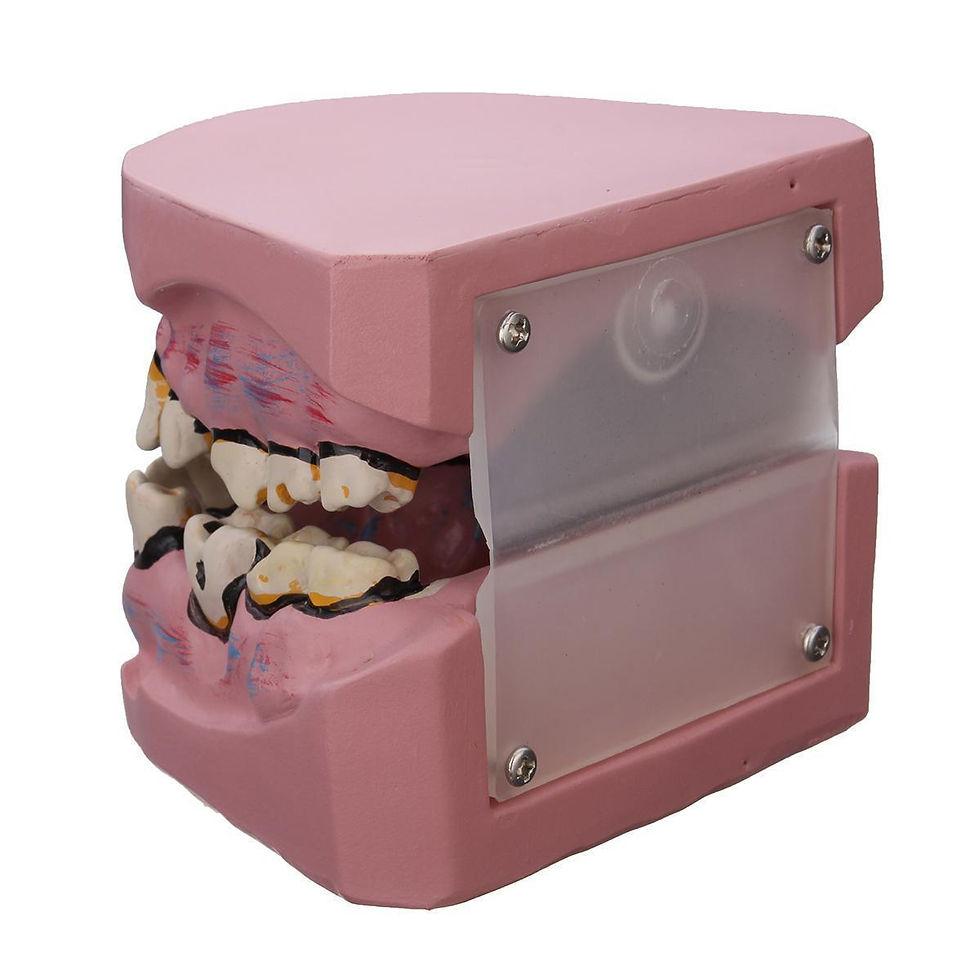 縮圖：Oral tooth model smoking harm smokers dental caries tooth decay yellow teeth pat