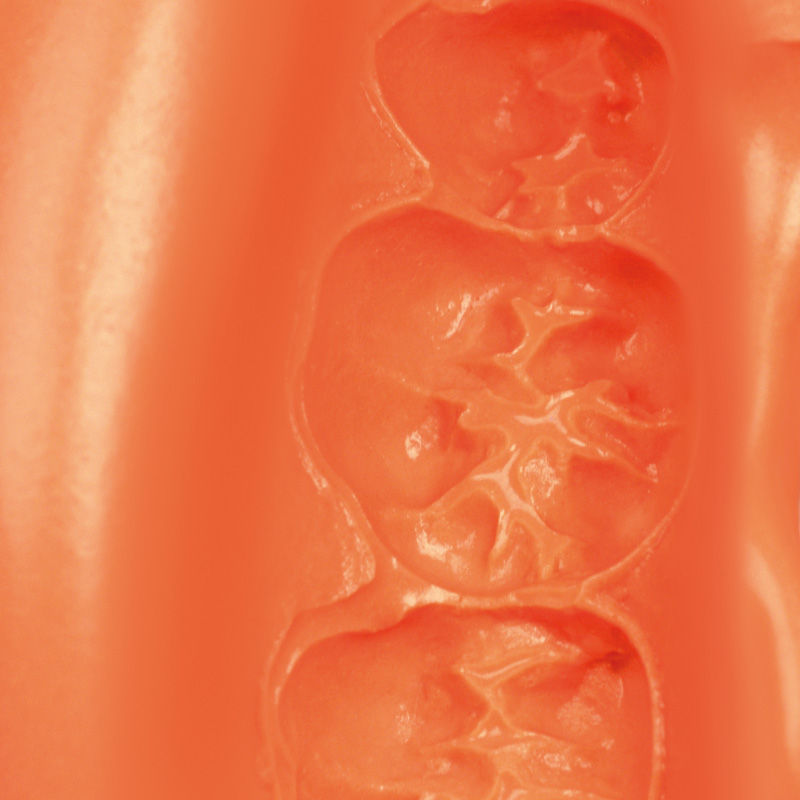 Thumbnail: Neocolloid Alginate
