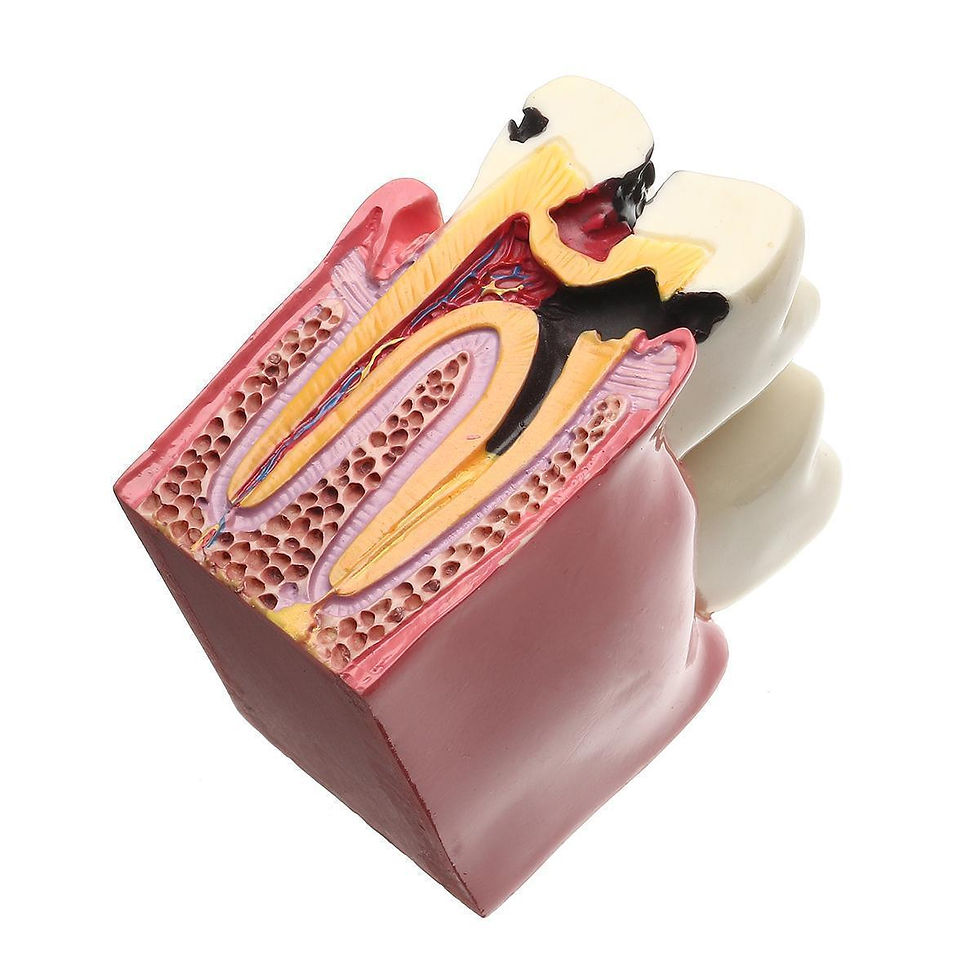 Thumbnail: 6 Times Caries Comparation Study Model