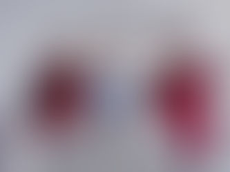 Reducing Emergency Department Bottlenecks